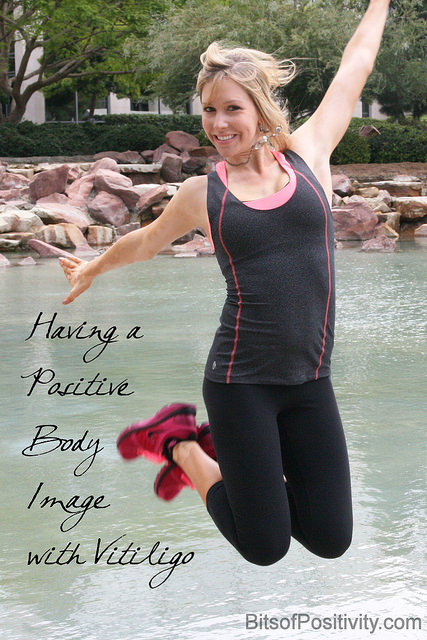 Having a Positive Body Image with Vitiligo